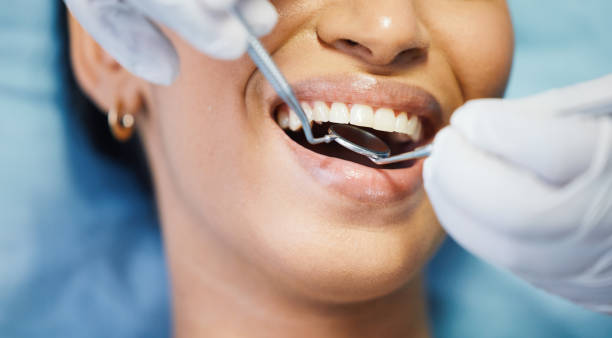 Best Emergency Wisdom Teeth Removal in Italy, TX